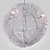  Modern Chandelier with 5 lights (Aluminum Shade)